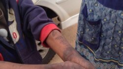 IUmntwana osesinde kusihudo samanzi eLuveve osexhathuka ezandlenni
