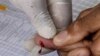 Blood Test Could Predict Longevity
