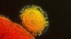 FILE - This file photo provided by the National Institute for Allergy and Infectious Diseases shows a colorized transmission of the MERS coronavirus that emerged in 2012. Health officials on Monday, May 12, 2014 confirmed a second U.S. case of the mysteri