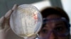 FILE - A laboratory worker looks for strains of E.coli bacteria in vegetable cells placed in a petri dish.