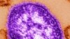An undated electron microscope image of a measles virus particle.